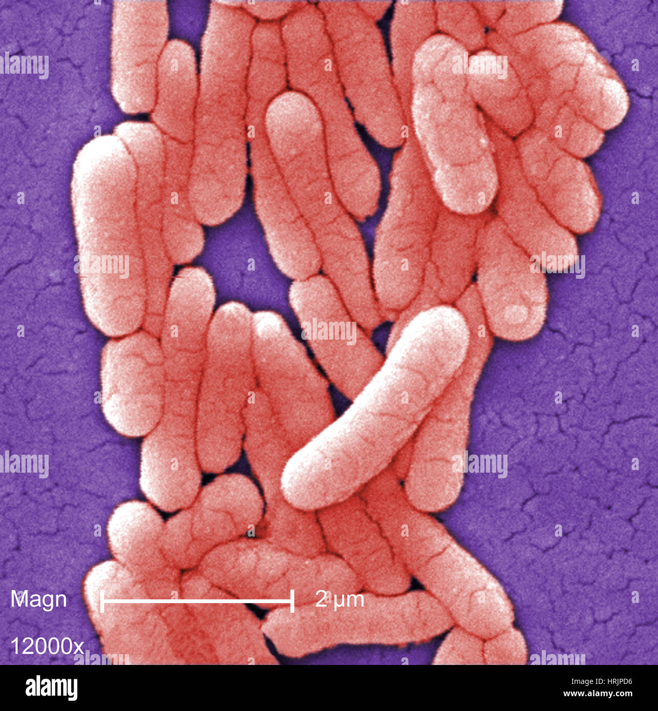 Salmonella Typhimurium Bakterien, SEM Stockfoto