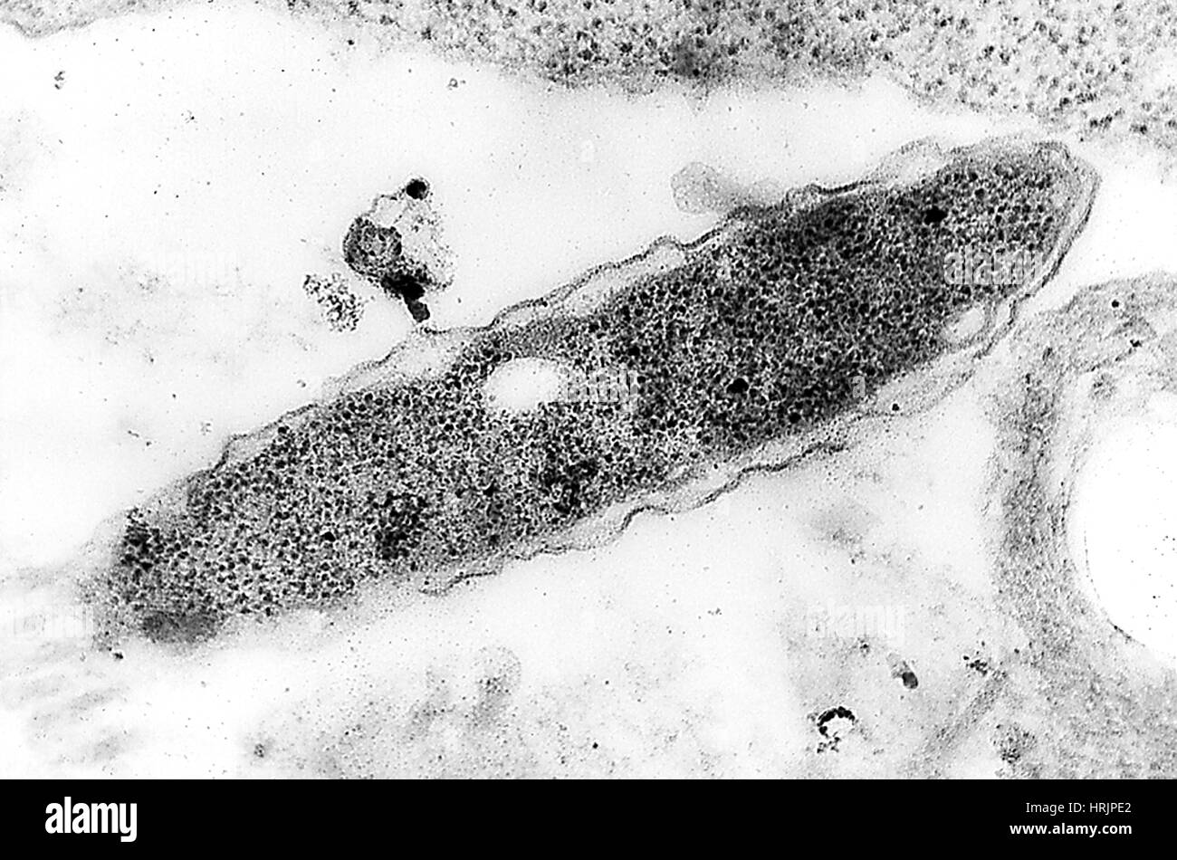 Legionella Pneumophila Bakterien, TEM Stockfoto