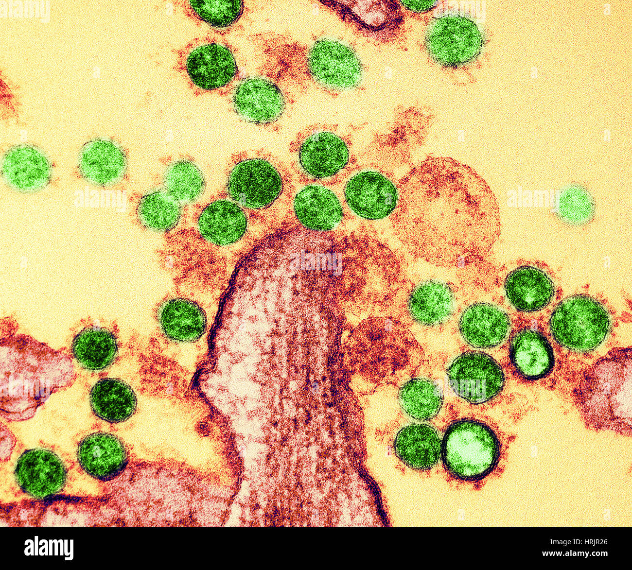 MERS Coronavirus Partikel, TEM Stockfoto