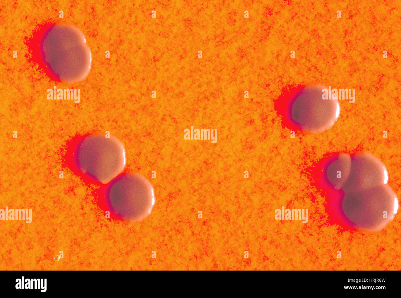 Corynebacterium Diphtheriae, kolonialen Wachstum Stockfoto