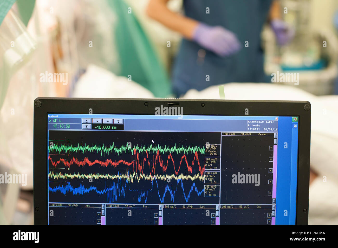 Monitor zeigt Herz Pulsfrequenz Spuren während des Betriebs. Stockfoto