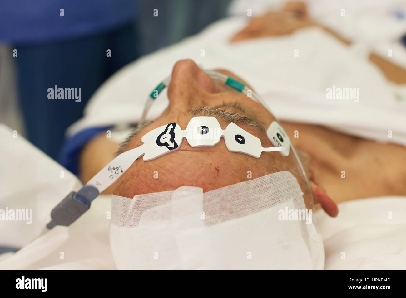 Patienten mit Elektroden rund um den Kopf, bevor Sie mit der stereotaktischen Chirurgie für die Parkinson Krankheit betrieben wird. Stockfoto