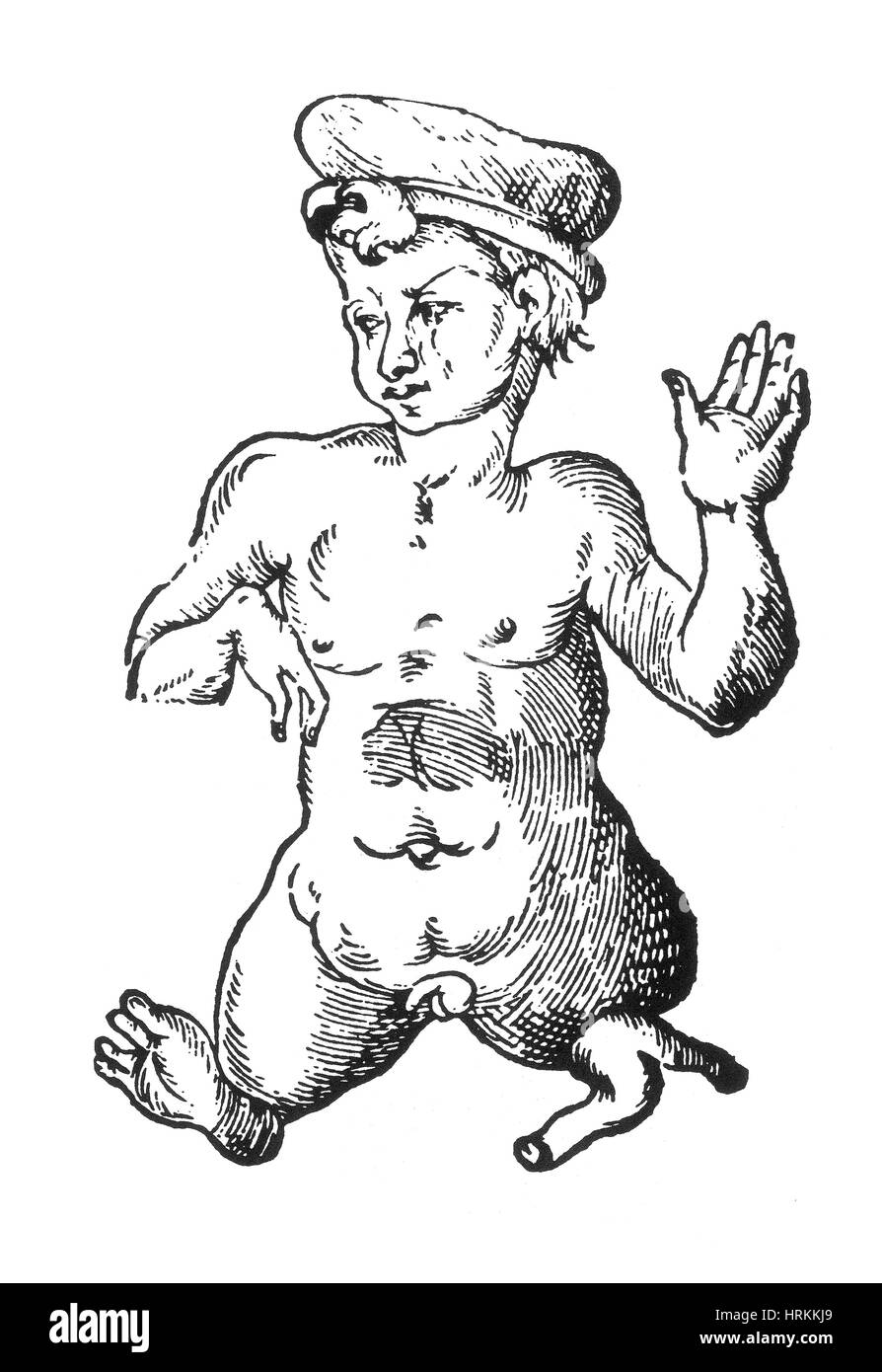 Monströse menschliche Kind, 16. Jahrhundert Stockfoto