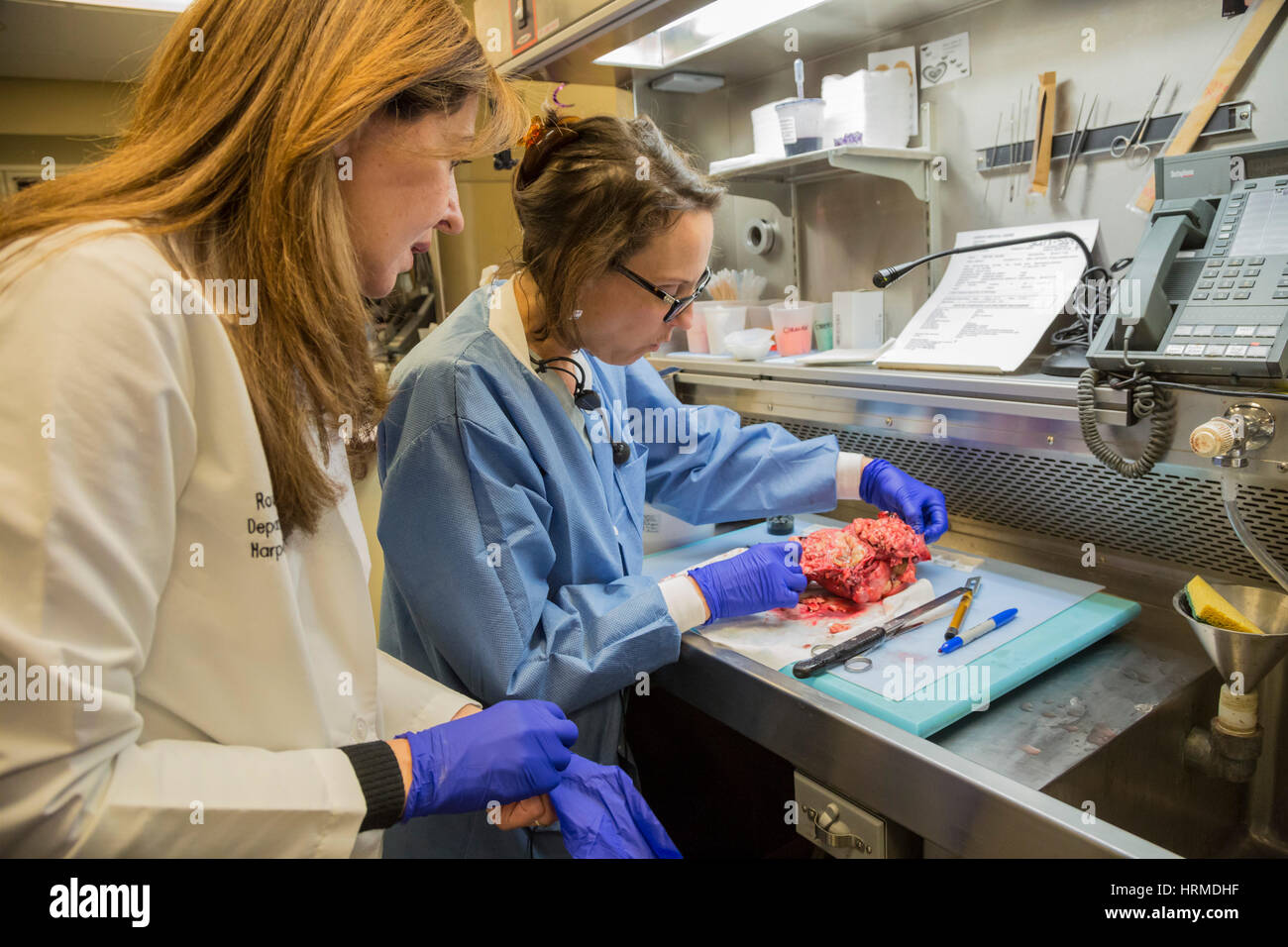 Detroit, Michigan - ein Pathologe und eine Pathologie-Assistentin am Detroit Medical Center untersuchen eine Gebärmutter mit endometrialen Adenokarzinom. Stockfoto