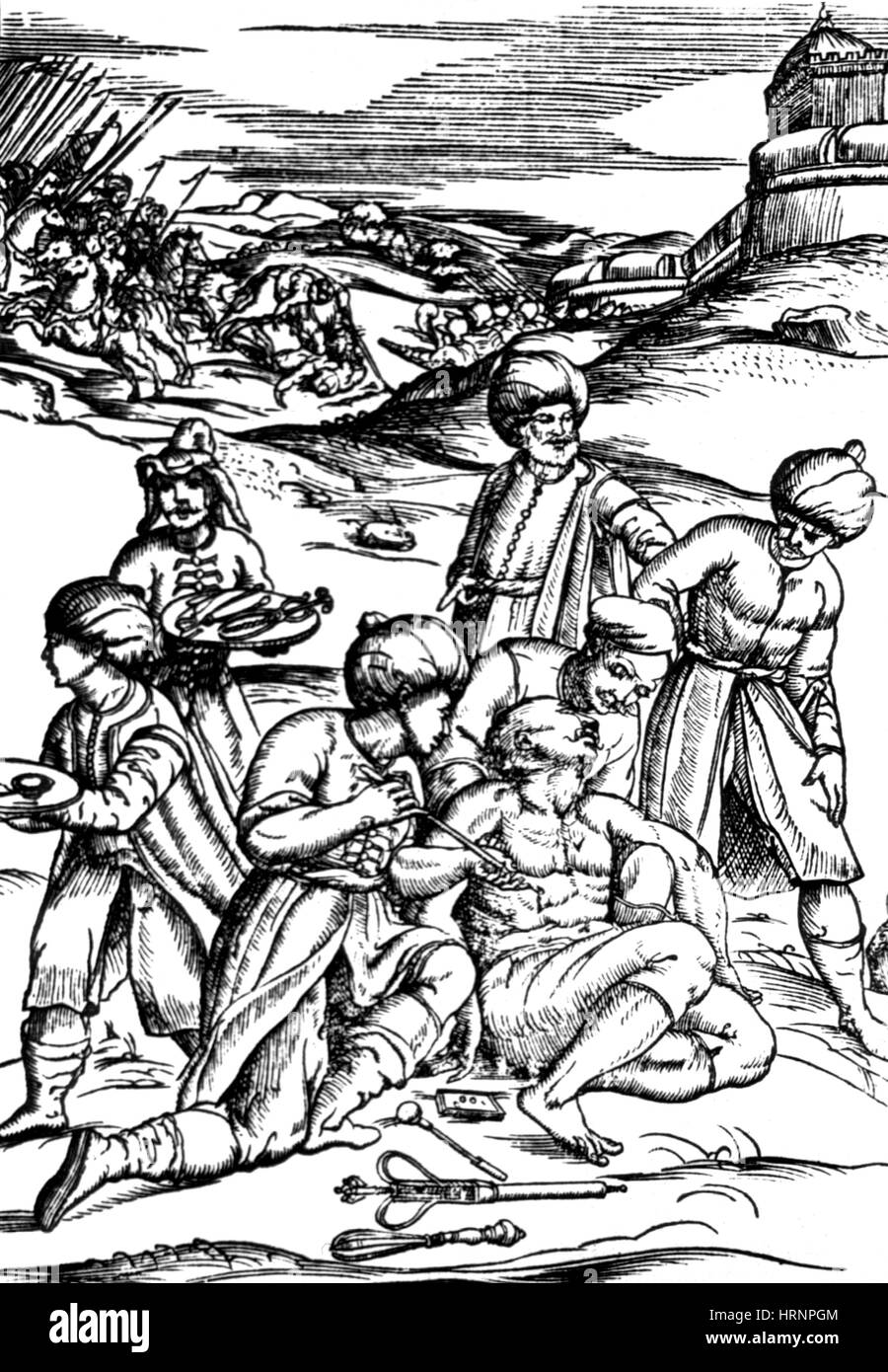 Schlachtfeld Medizin, 16. Jahrhundert Stockfoto