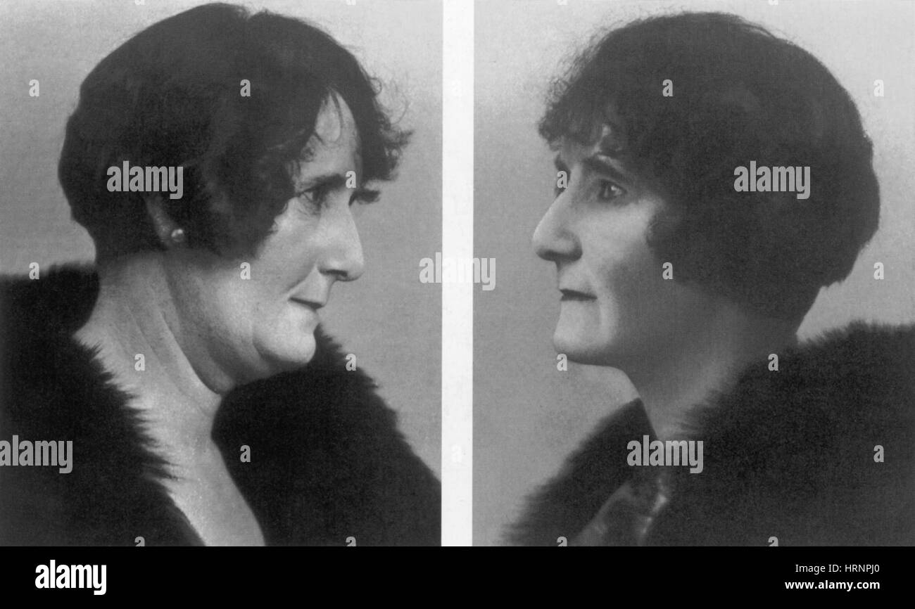 Facelift, c. 1920er Jahre Stockfoto