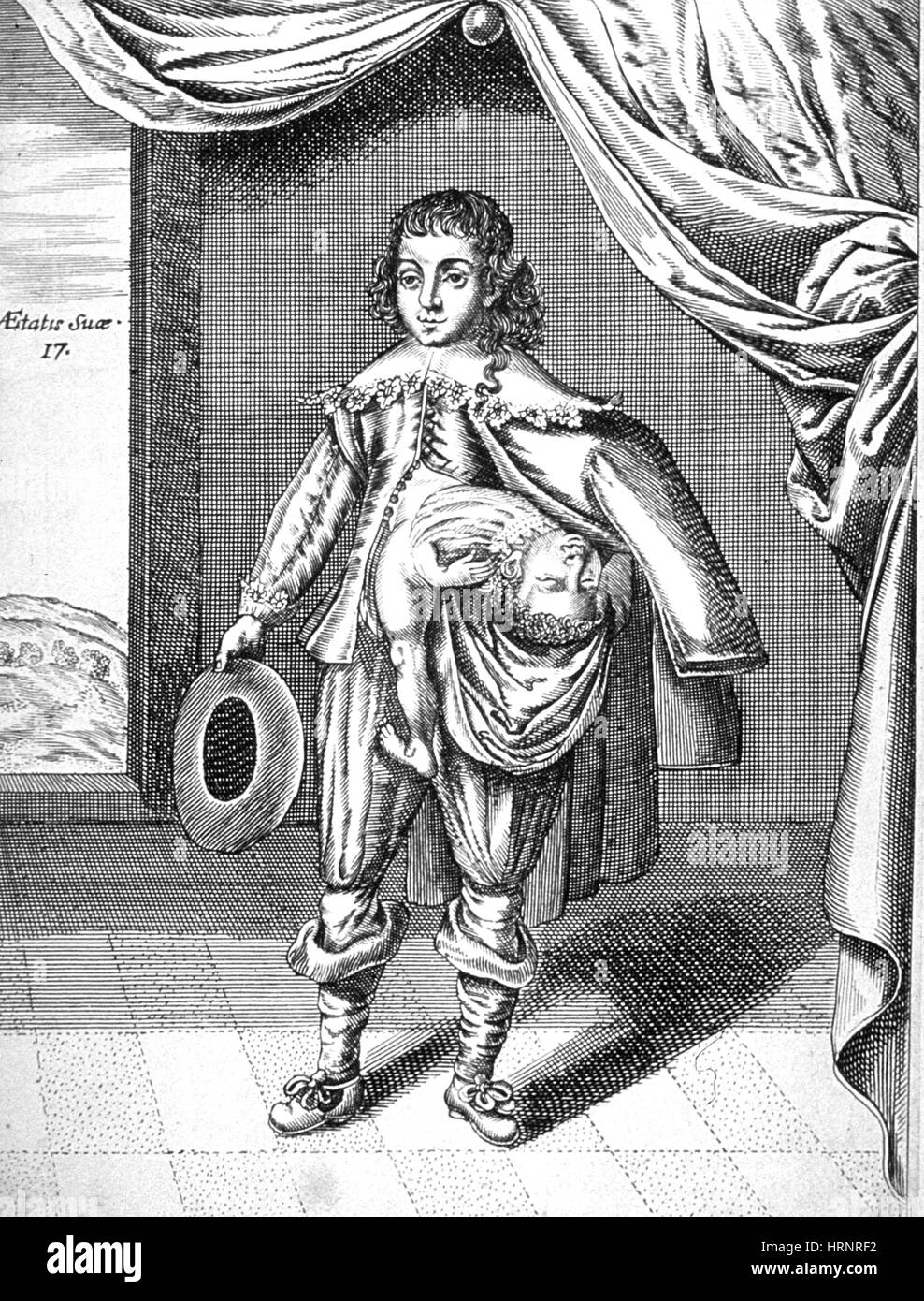 Parasitären Zwilling, 1686 Stockfoto