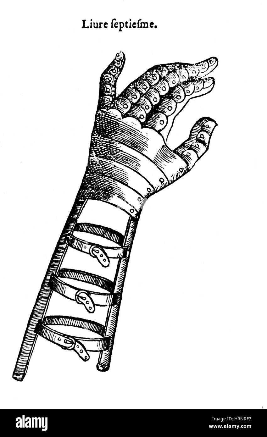 Künstliche Hand entworfen von Ambroise Par̩, 1564 Stockfoto