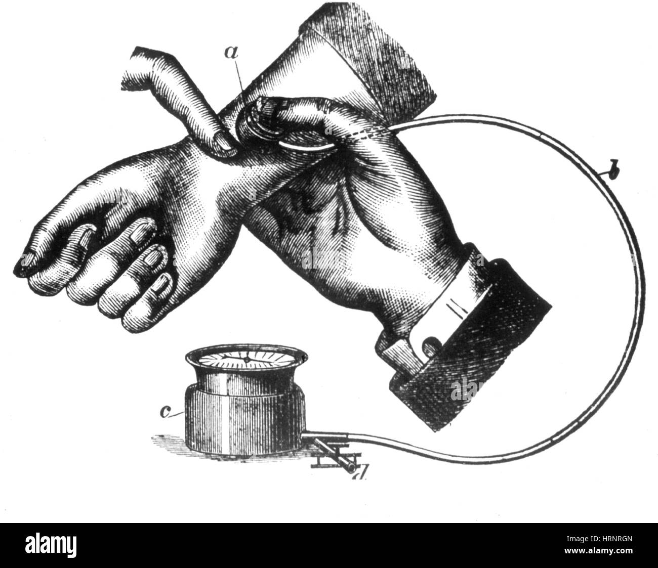 Blutdruckmessgerät, 1883 Stockfoto