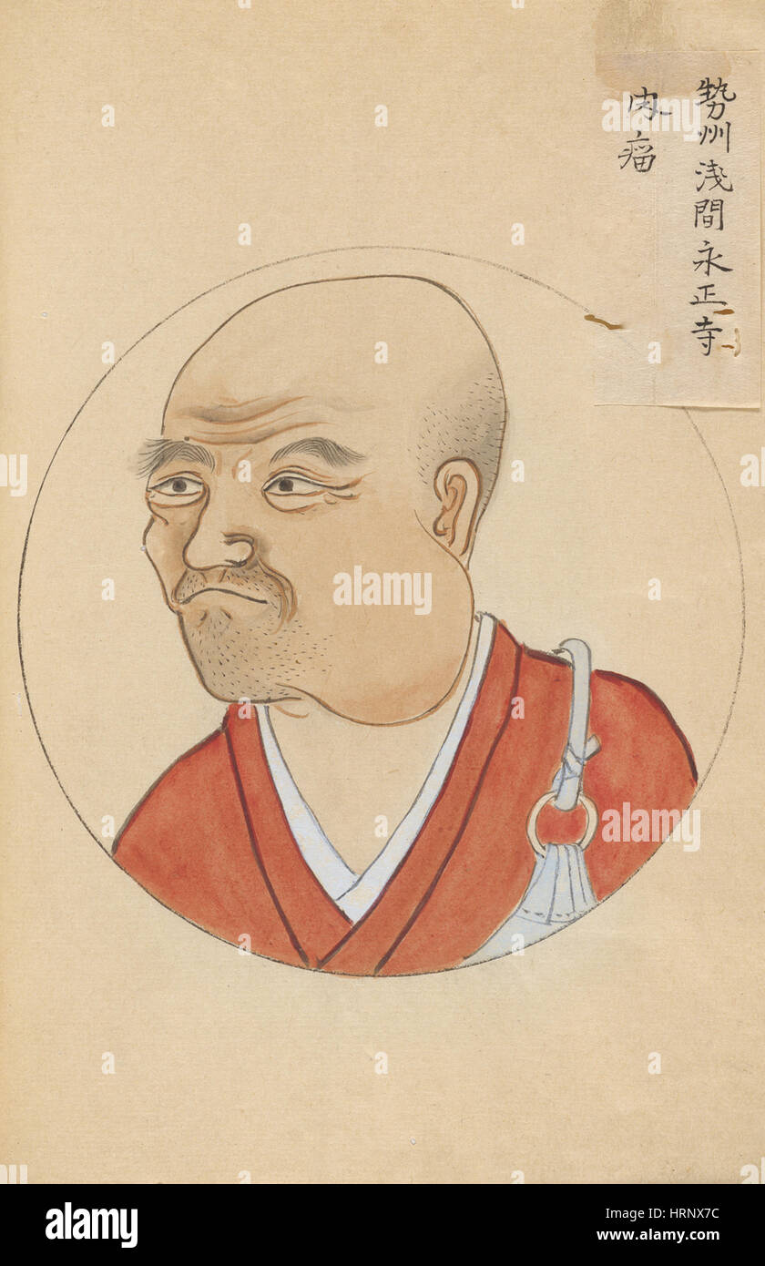 Tumor des Kiefers, "Chirurgische Casebook" Stockfoto