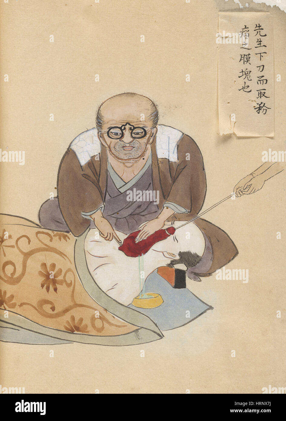 Hanaoka Seishu Durchführung Chirurgie Stockfoto