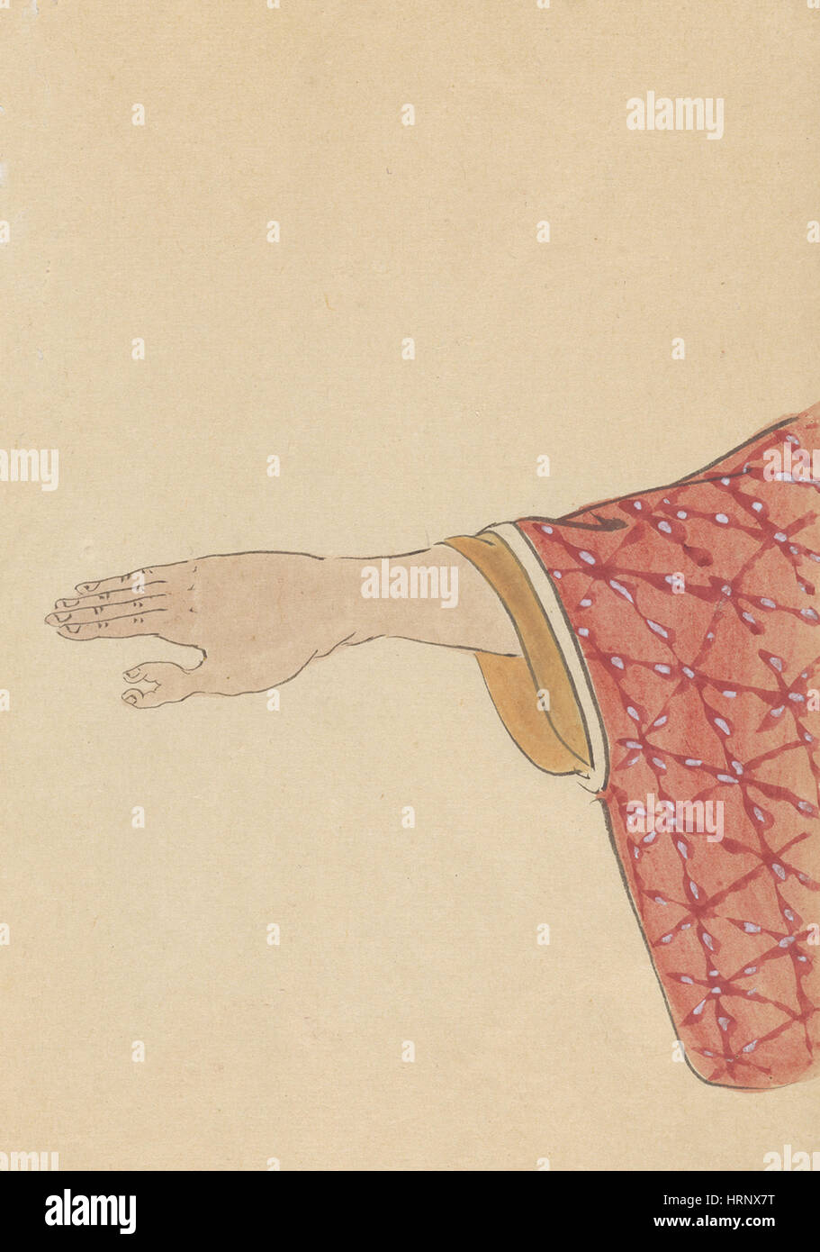 Polydaktylie, "Chirurgische Casebook" Stockfoto