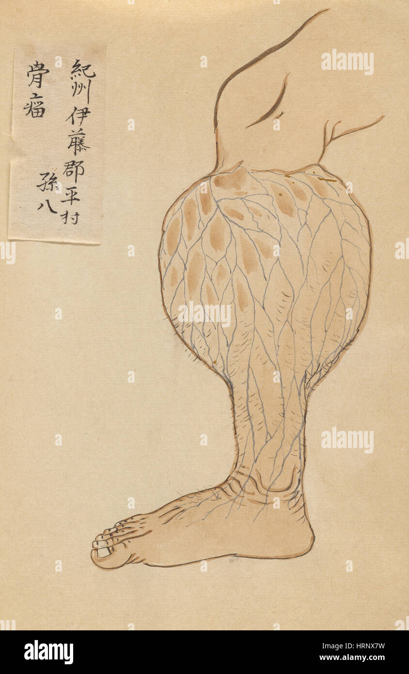 Netz von Adern, "Chirurgische Casebook" Stockfoto
