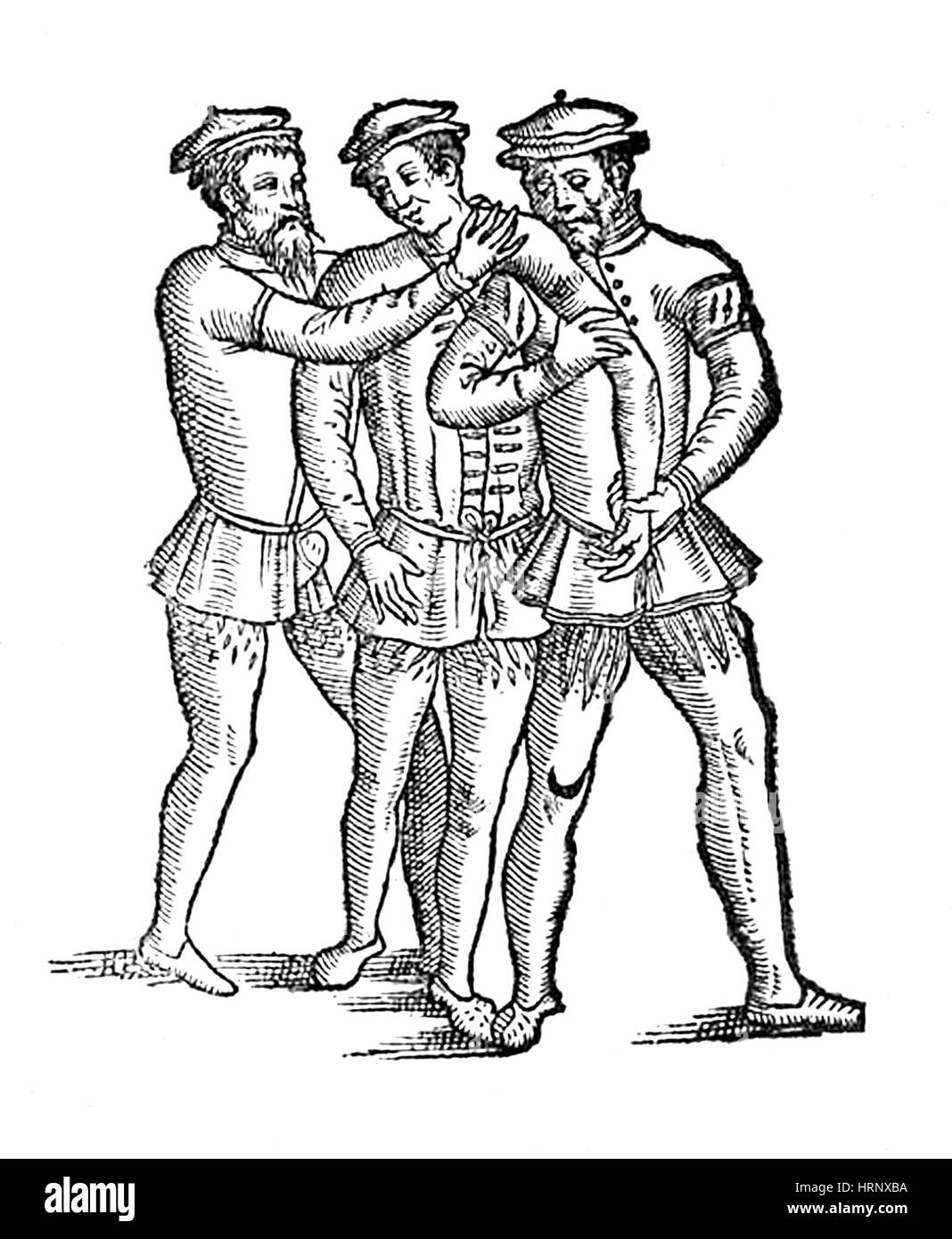 Ausgekugelte Schulter Apparat, 16. Jahrhundert Stockfoto