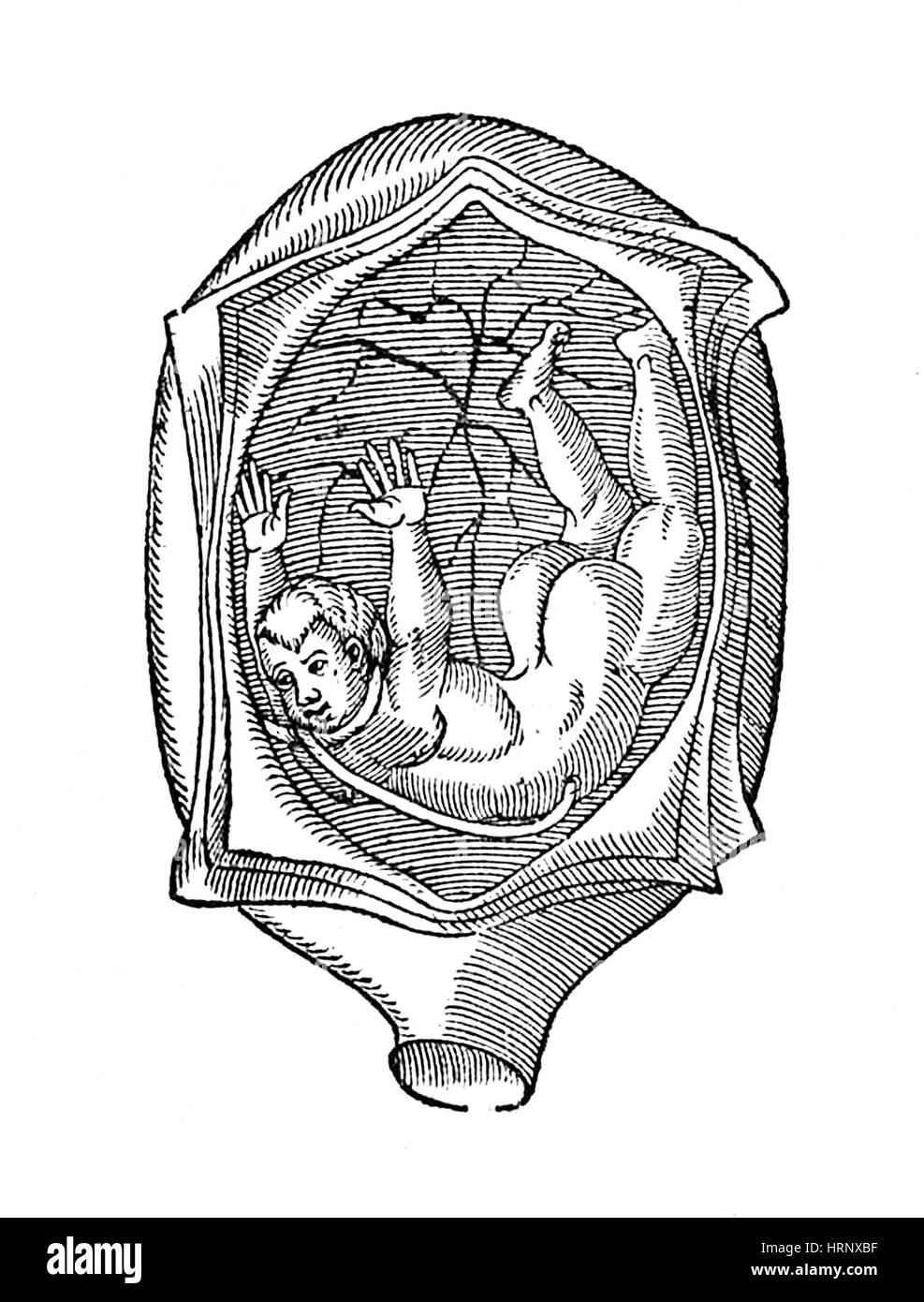 Ambroise Par̩, abnorme fetale Präsentation, 1585 Stockfoto