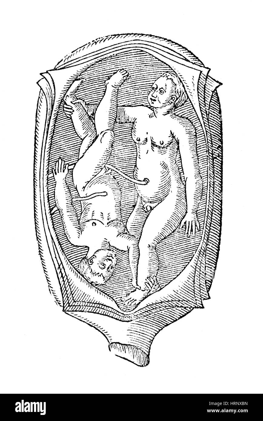 Ambroise Par̩, abnorme fetale Präsentation, 1585 Stockfoto