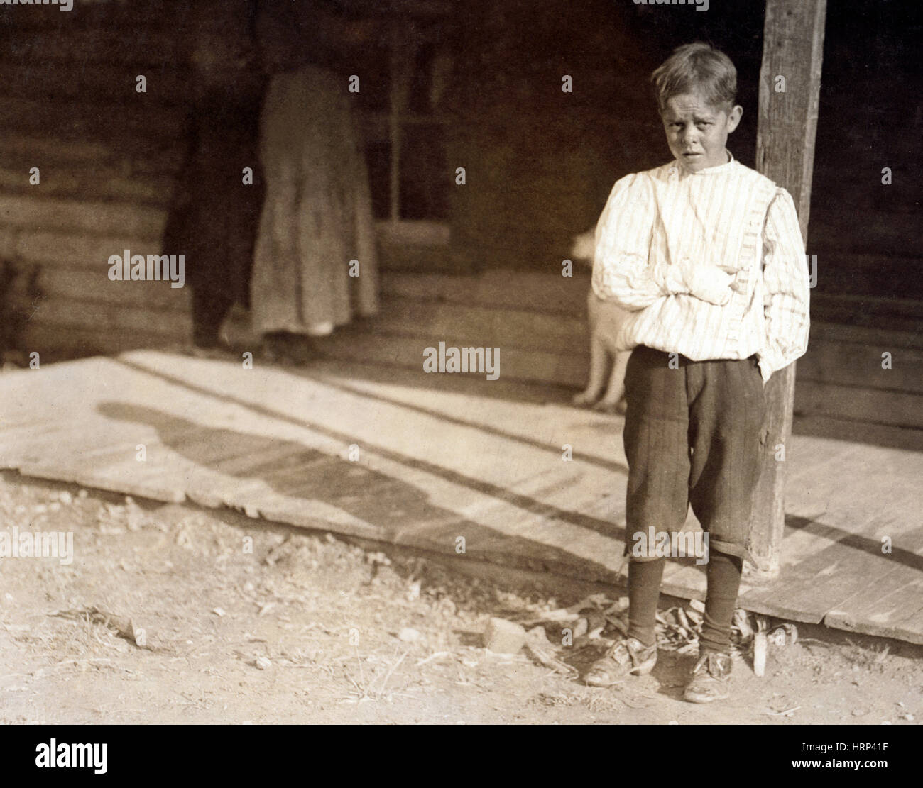 Kinderarbeit, Arbeitsunfall, 1912 Stockfoto