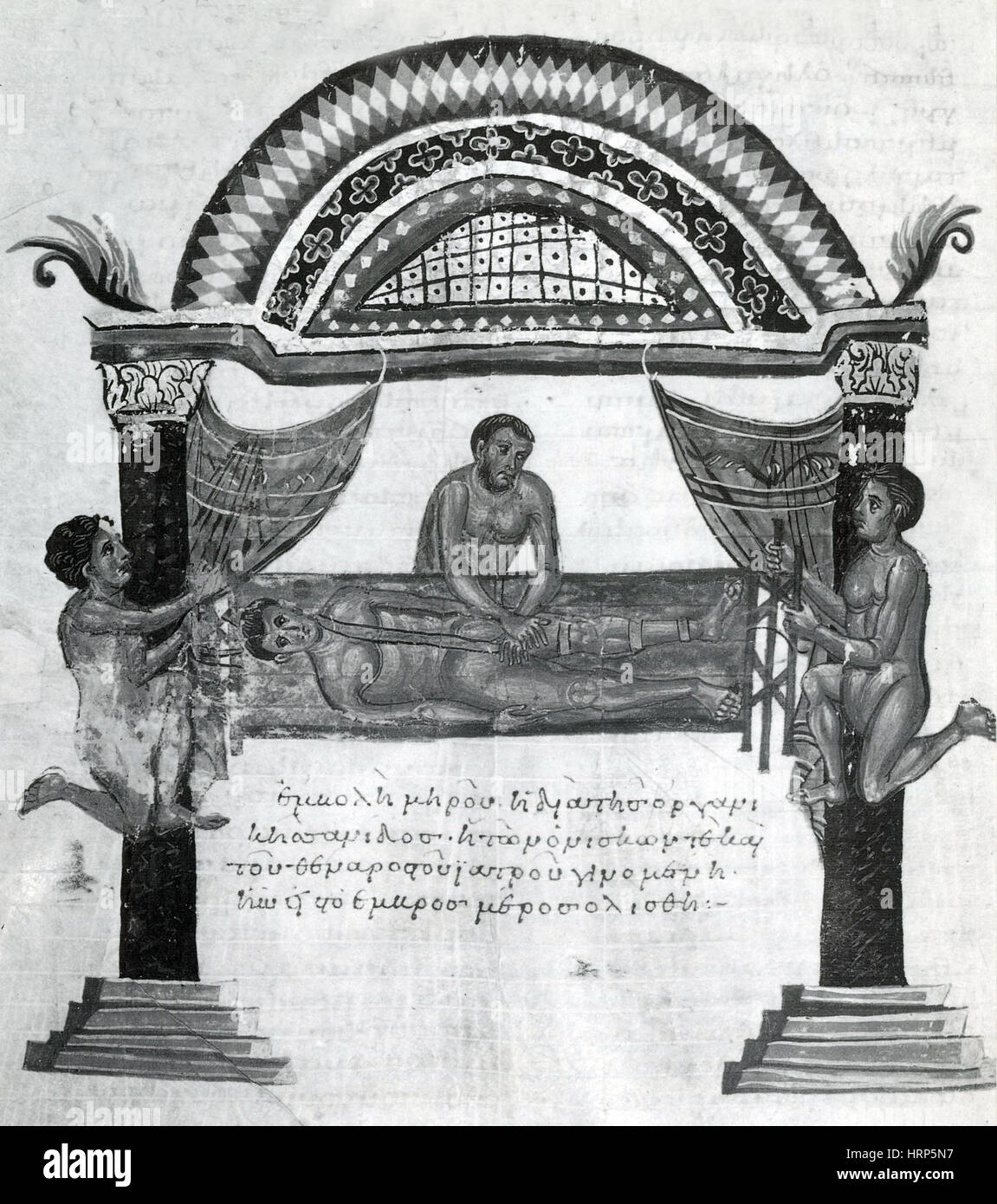 Gemeinsame Luxation Behandlung, 1. Jahrhundert v. Chr. Stockfoto