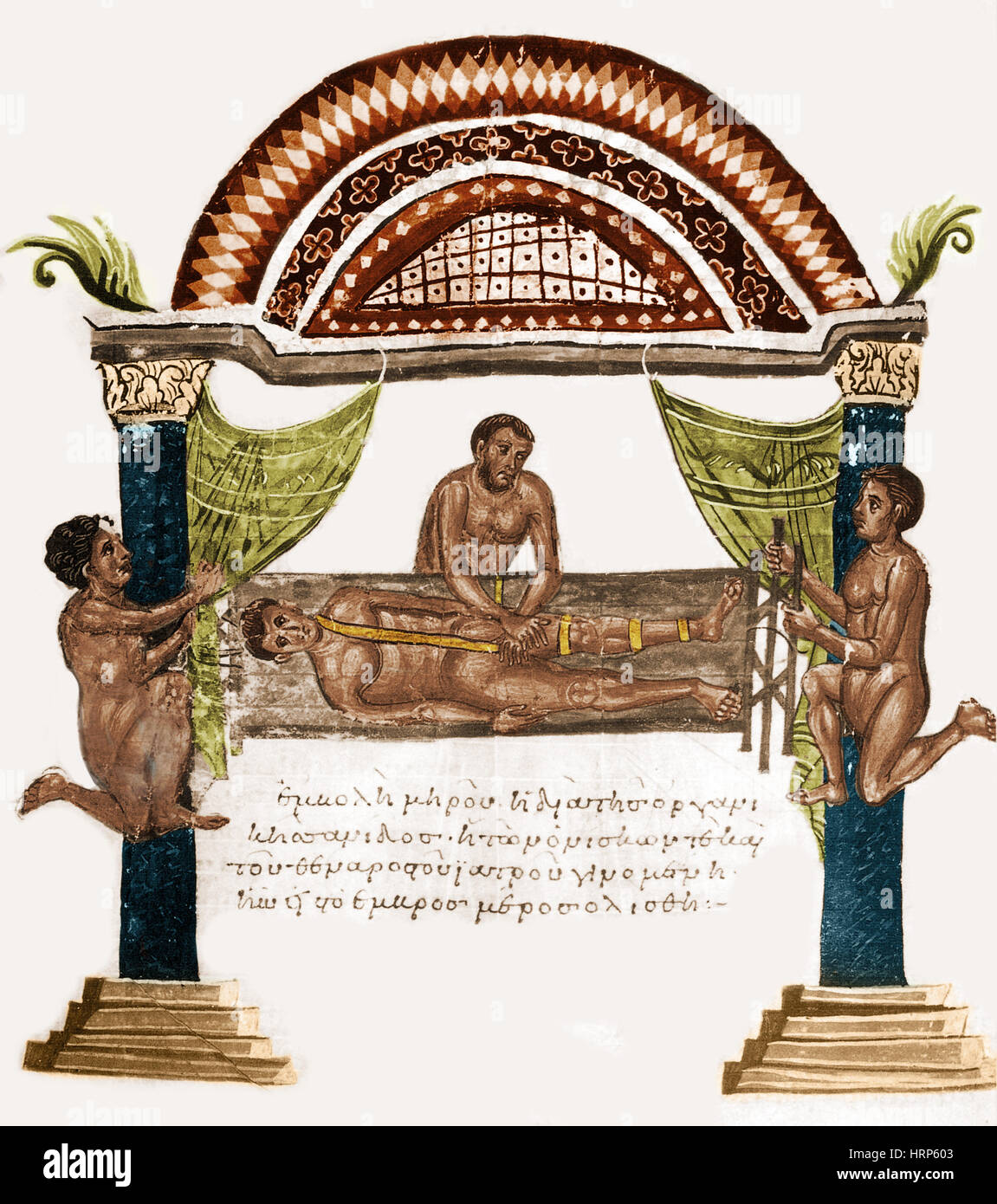 Gemeinsame Luxation Behandlung, 1. Jahrhundert v. Chr. Stockfoto