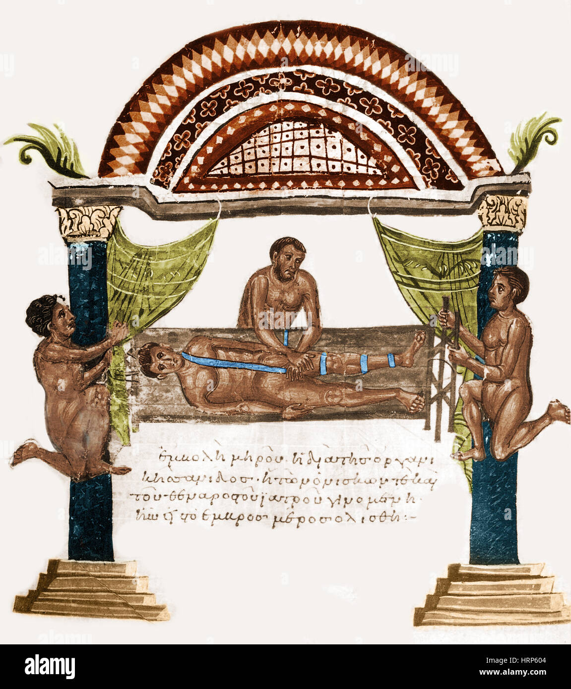 Gemeinsame Luxation Behandlung, 1. Jahrhundert v. Chr. Stockfoto