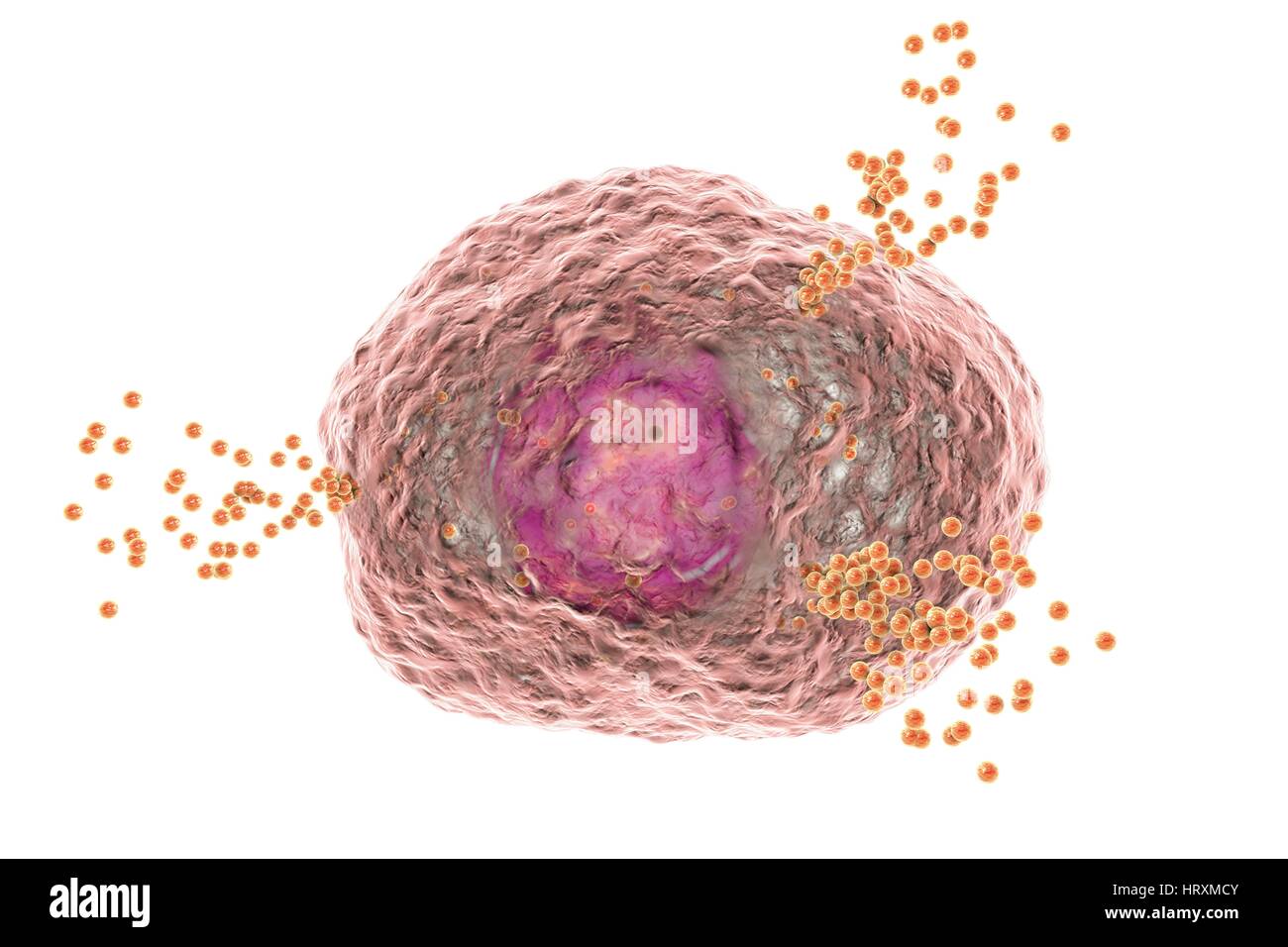 Mastzellen Histamin bei allergischen Reaktion, Computer Illustration die Freigabe. Mastzellen sind äußerst (weiße Blutzellen). Sie enthalten chemische Mediatoren Histamin, Serotonin Heparin. Histamin wird von Mastzellen in Reaktion auf Allergen verursacht lokalisierte entzündlichen immunen befreit. Stockfoto
