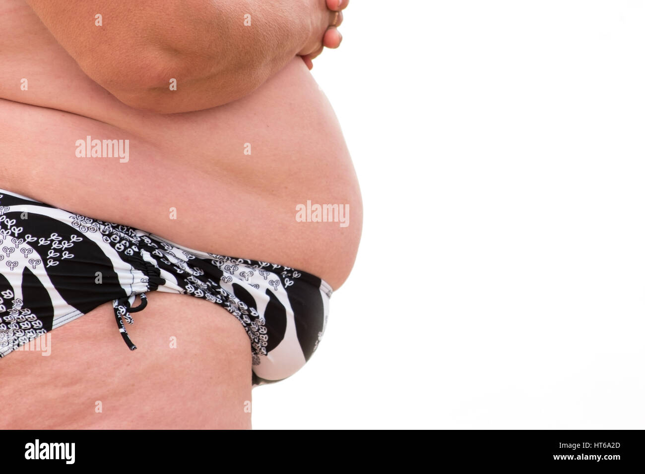 Eine fette Frau Bauch. Übergewichtigen Körper isoliert. Gesundheit ist in Gefahr. Nachwirkungen von übermäßigem Essen. Stockfoto