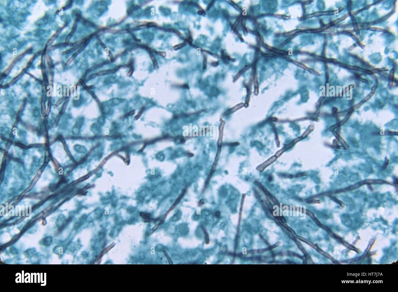 Histologischen Veränderungen im Falle eines Phaeohyphomycosis, eine Pilzinfektion verursacht durch E. Pisciphilus, in Acatfish Gewebeprobe, zubereitet mit Methenamin Silber Fleck, 1973. Bild mit freundlicher Genehmigung CDC/Dr. Libero Ajello. Stockfoto