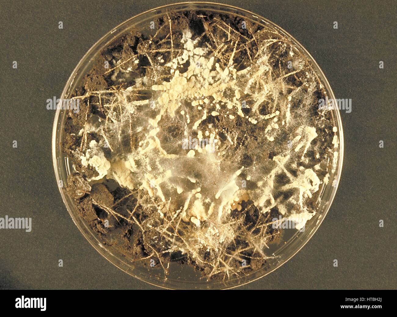 Erde-Haare Platte Kultur wächst der Pilz Microsporum Gypseum, die Tinea Corporis und Tinea Capitis bei Mensch und Tier, 1973 führen kann. Bild mit freundlicher Genehmigung CDC/Dr. Libero Ajello. Stockfoto