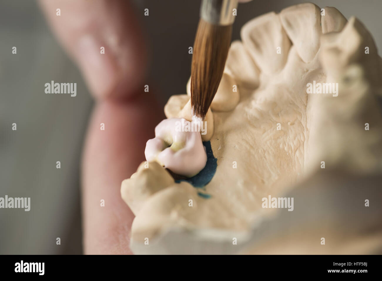 Zahnersatz, Zahnersatz, Prothetik, Hände an die Prothese, falsche Zähne zu arbeiten. Stockfoto
