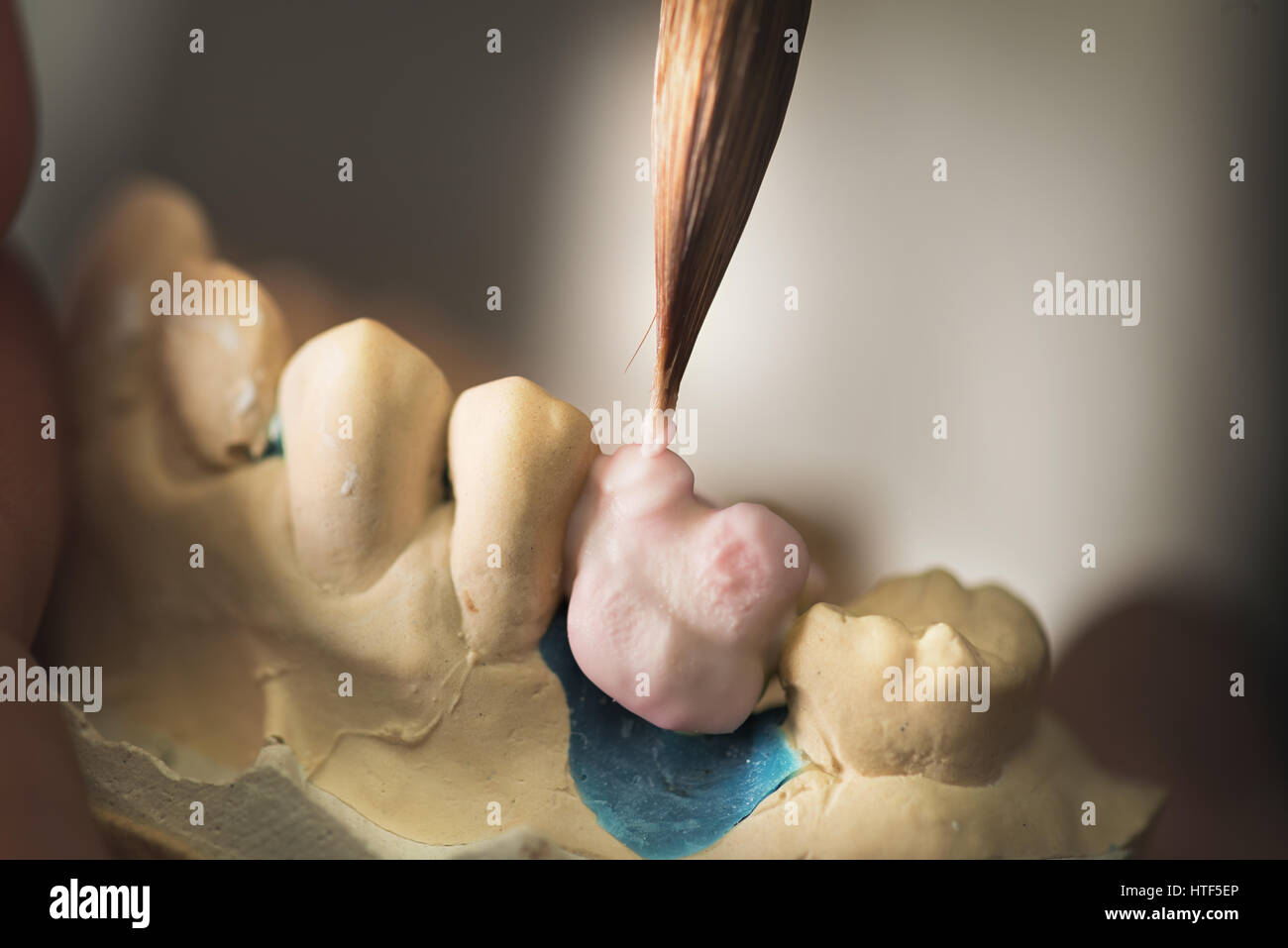 Zahnersatz, Zahnersatz, Prothetik, Hände an die Prothese, falsche Zähne zu arbeiten. Stockfoto