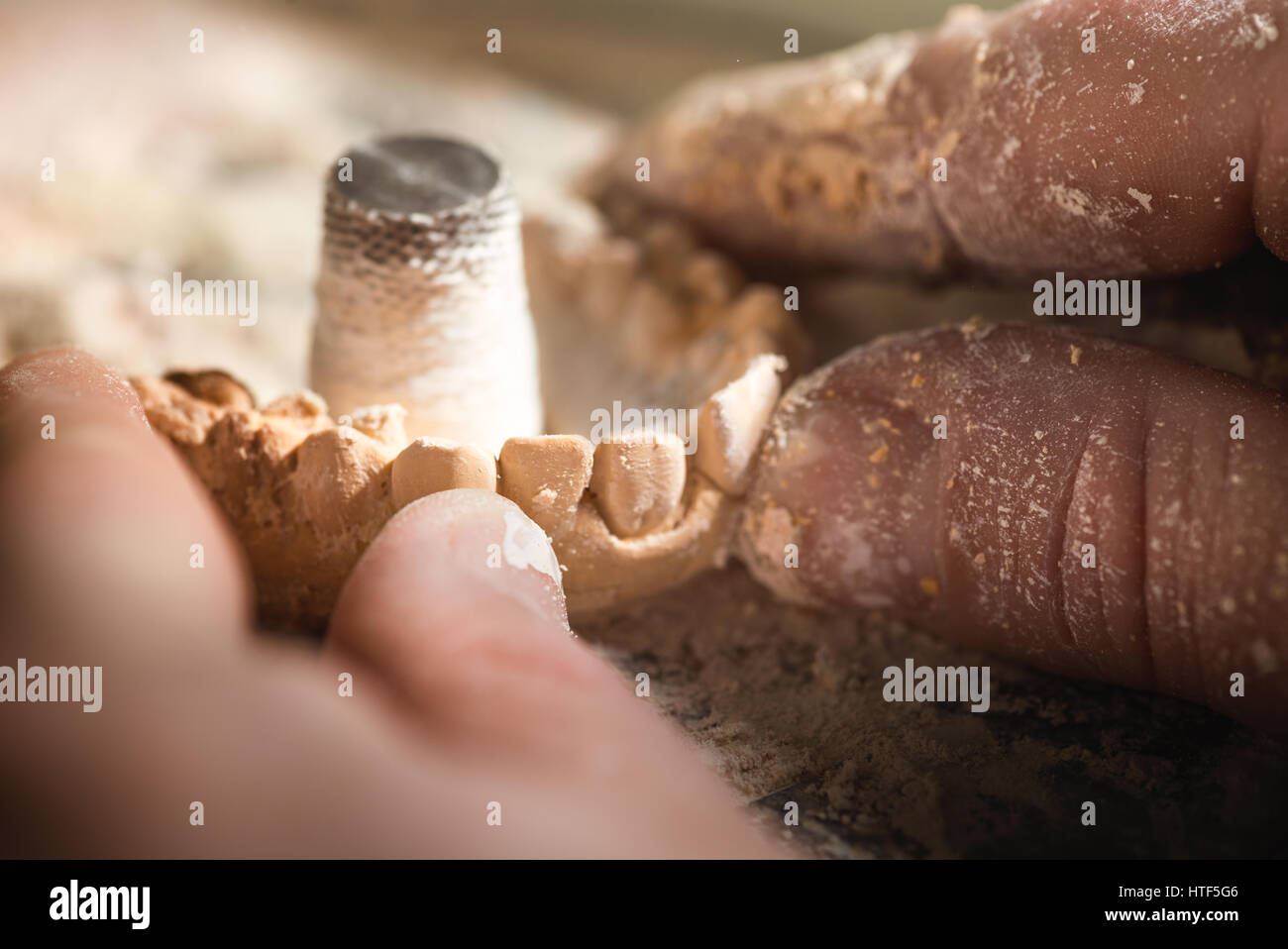 Zahnersatz, Zahnersatz, Prothetik, Hände an die Prothese, falsche Zähne zu arbeiten. Stockfoto