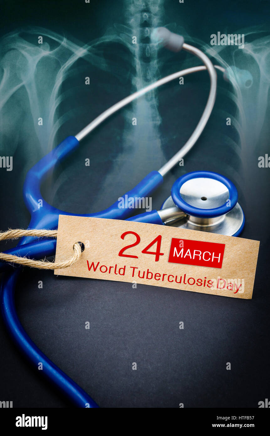 Welt-Tuberkulose-Tag und Röntgen der Lunge Lunge Krankheit Lunge mit Stethoskop medizinische. Stockfoto