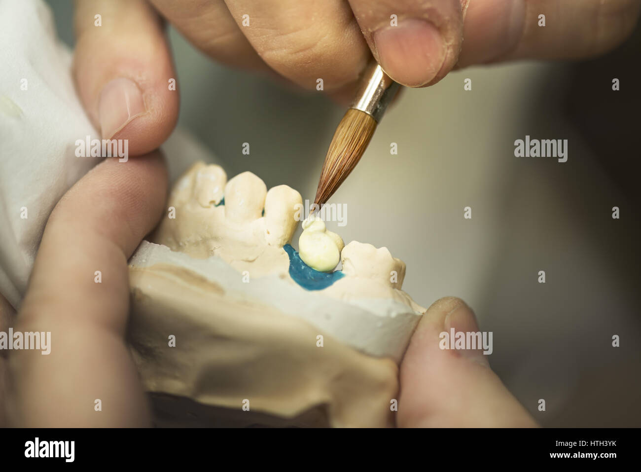 Zahnersatz, Zahnersatz, Prothetik, Hände an die Prothese, falsche Zähne zu arbeiten. Stockfoto