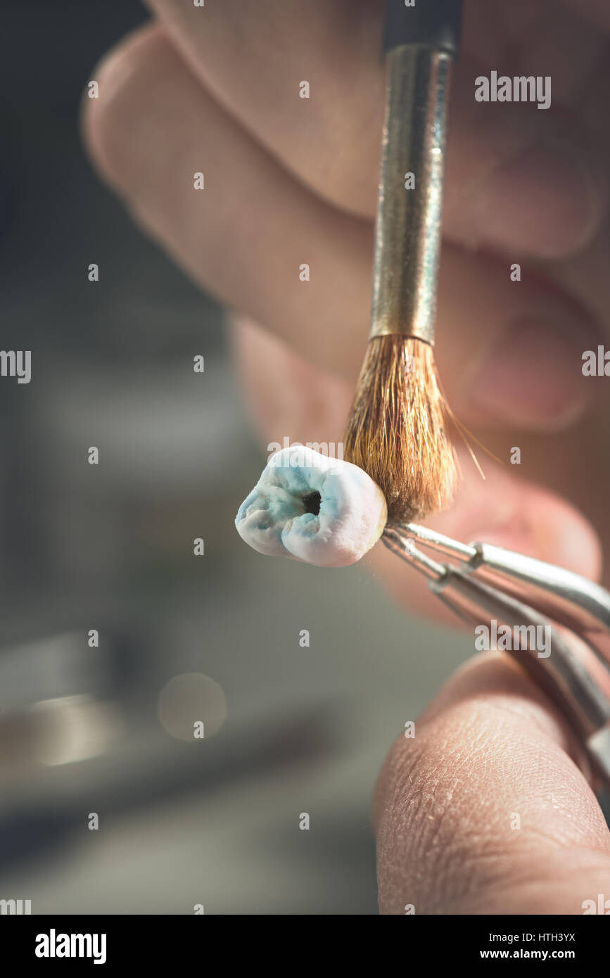 Zahnersatz, Zahnersatz, Prothetik, Hände an die Prothese, falsche Zähne zu arbeiten. Stockfoto