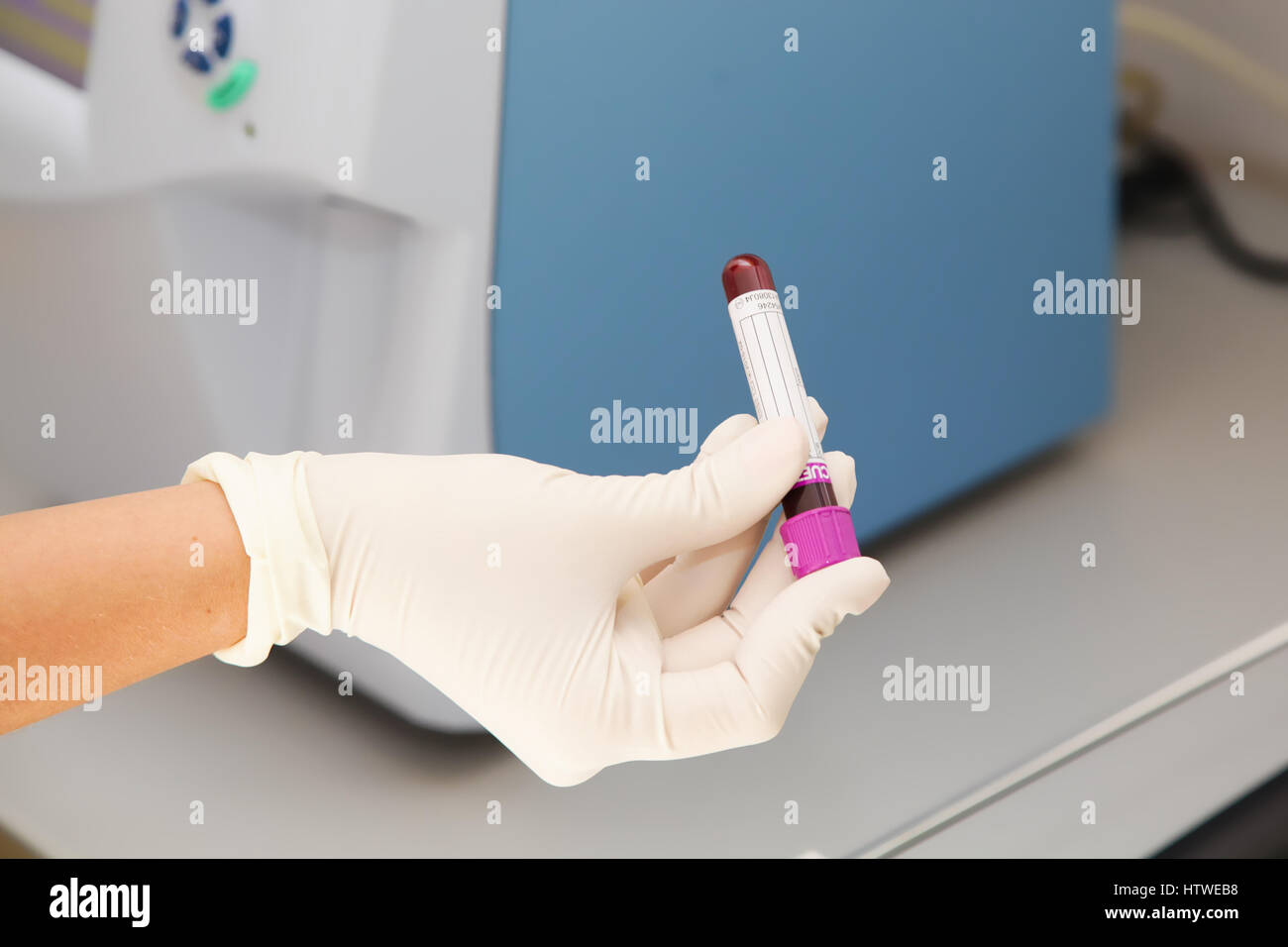 Labor-Techniker schütteln Blutprobe für analysieren Stockfoto
