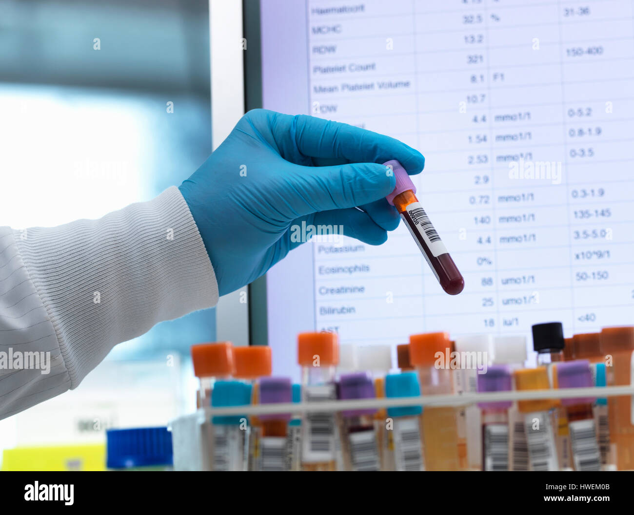 Blutanalyse, Hämatologen Vorbereitung medizinische Proben, einschließlich des Blutes mit Ergebnissen auf dem Computerbildschirm zu Testzwecken Stockfoto