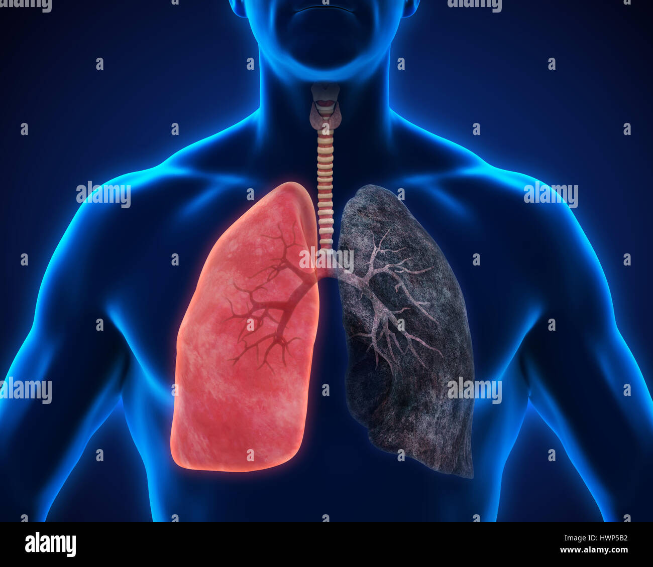 Gesunde Lunge und Raucher-Lunge Stockfotografie - Alamy