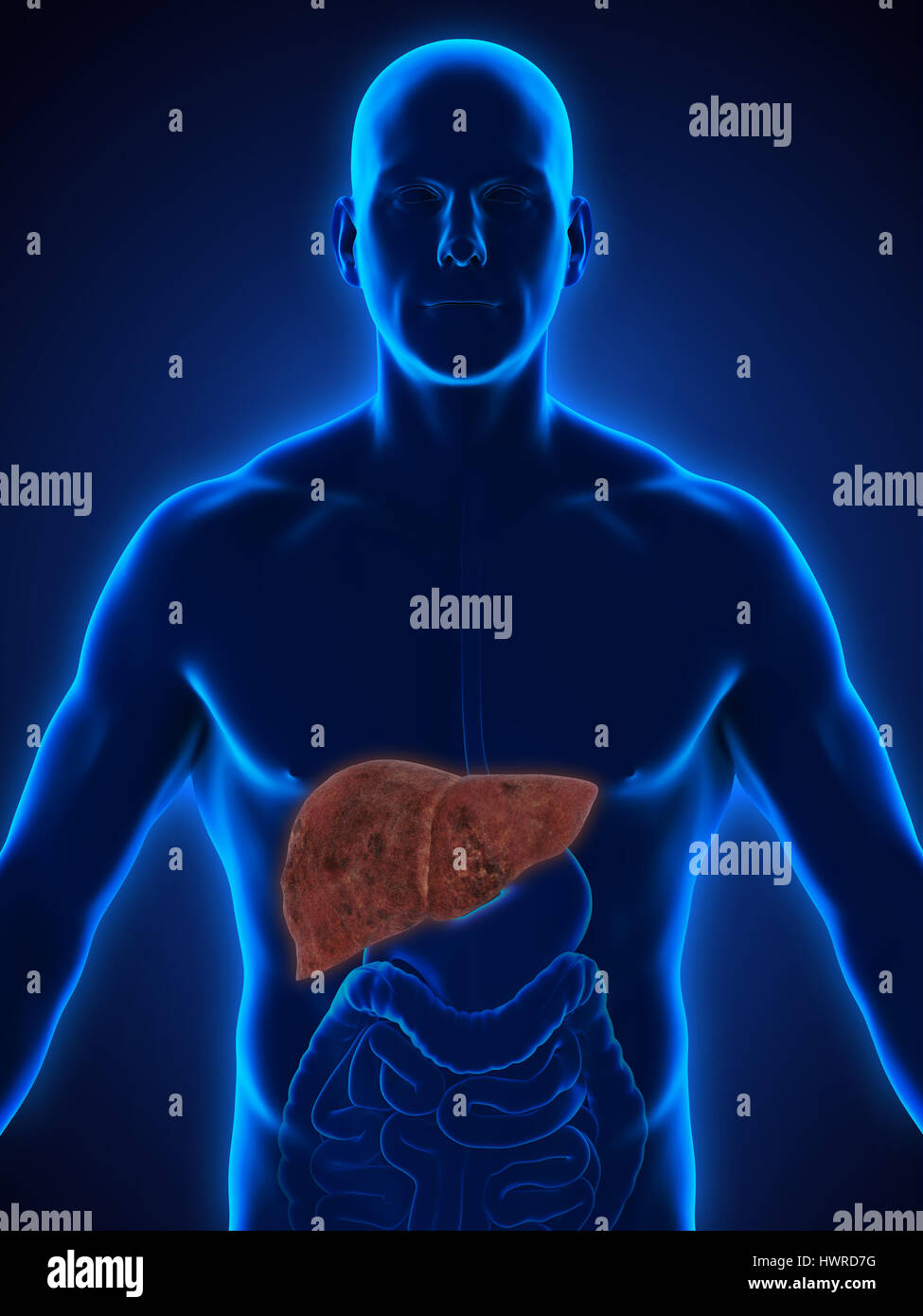 Ungesunde Leber Anatomie Stockfoto