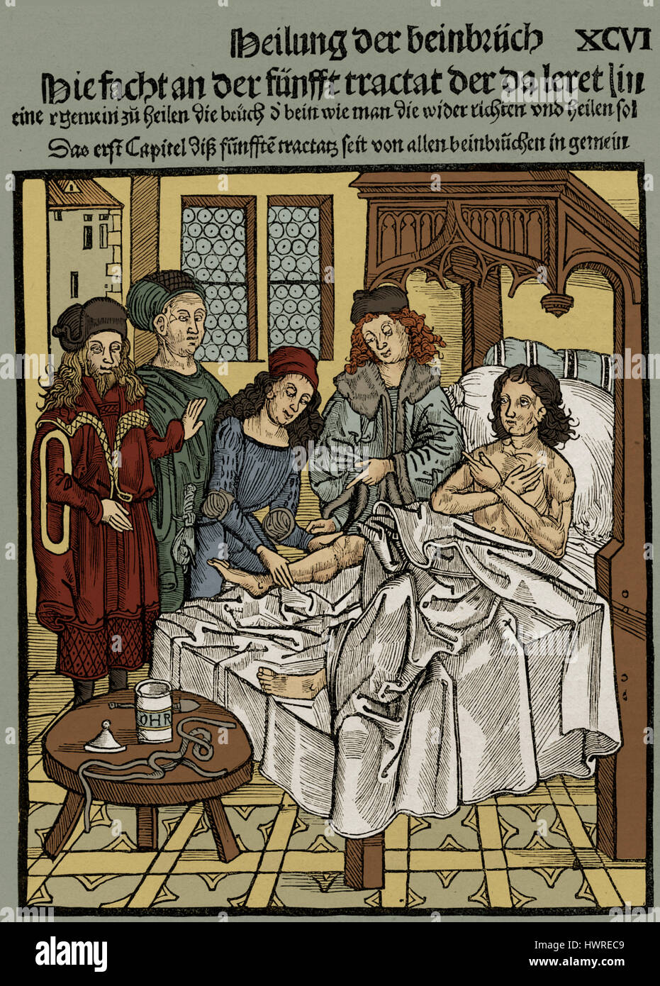 Ärzte ausbessern ein gebrochenes Bein, Holzschnitt, Deutschland c. 15. Jahrhundert Stockfoto