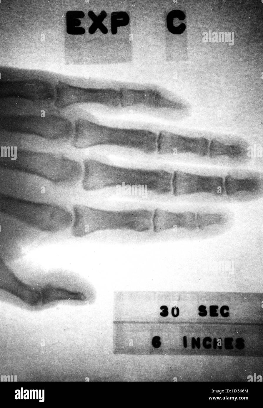 Ein kleines x-ray System angetrieben von Promethium 147 und etwa so groß wie eine Zigarette-Paket wurde entwickelt von Armour Research Foundation AEC-Vertrag, Bild mit freundlicher Genehmigung US Department of Energy, 2014. Stockfoto