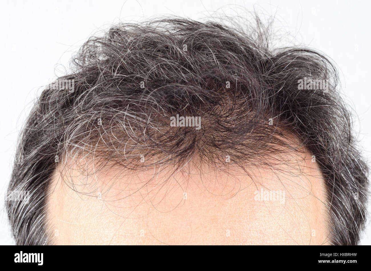 Reifer Mann Haarausfall Problem. Health care Shampoo und Schönheit Produkt Konzeptionierung Stockfoto