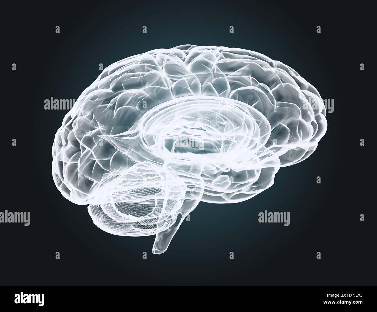 Gehirn-Scan Röntgen auf dunklem Hintergrund Stockfoto