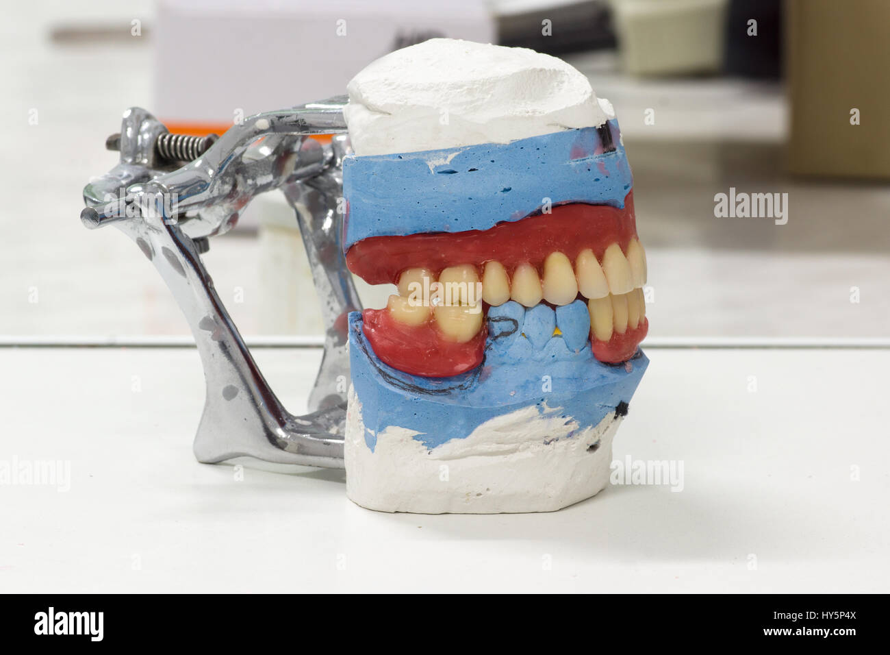 Zahnersatz in der Fertigungsschritte im Dentallabor Stockfoto