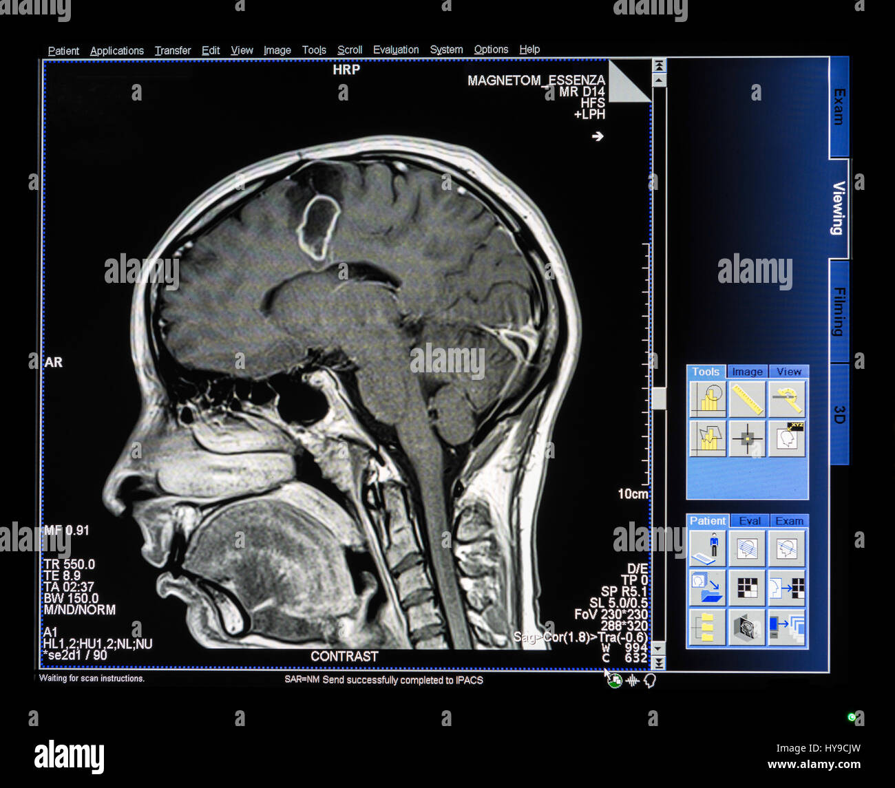 MRI Scan Monitor mit Scan-Bild des Kopfes Stockfoto