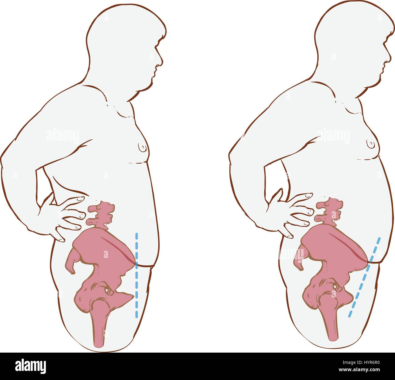 Weißem Hintergrund Vector Illustration eines Vorwärts hip kippen Stock Vektor Weißem Hintergrund Vector Illustration eines Vorwärts hip kippen Stock Vektor