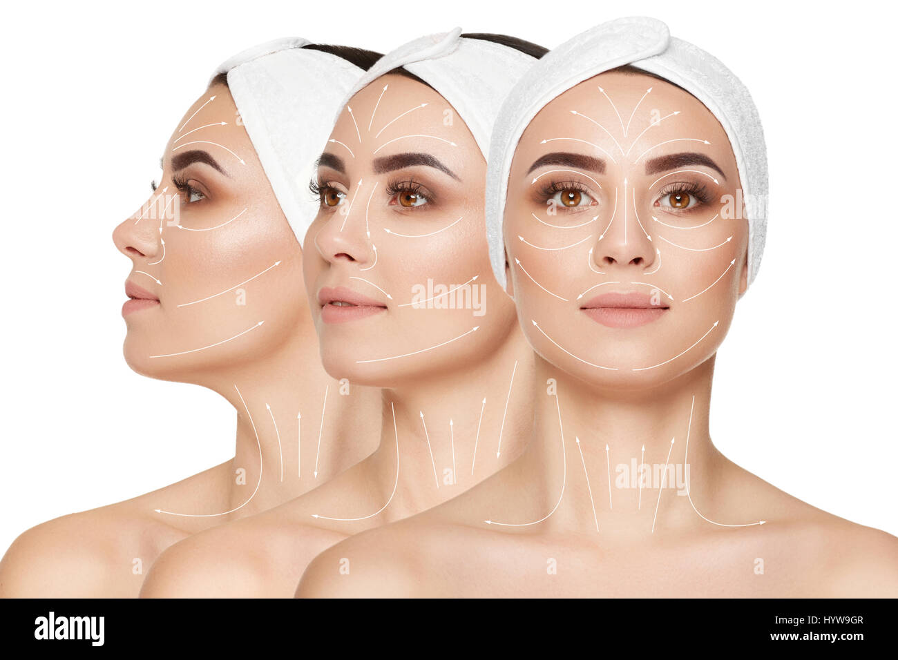 Collage der junge attraktive Brünette Mädchen mit gepflegten Haut nach Beauty-Salon mit virtuellen Schema auf Gesicht, tragen in der Bandage am Kopf. Andere Seite o Stockfoto
