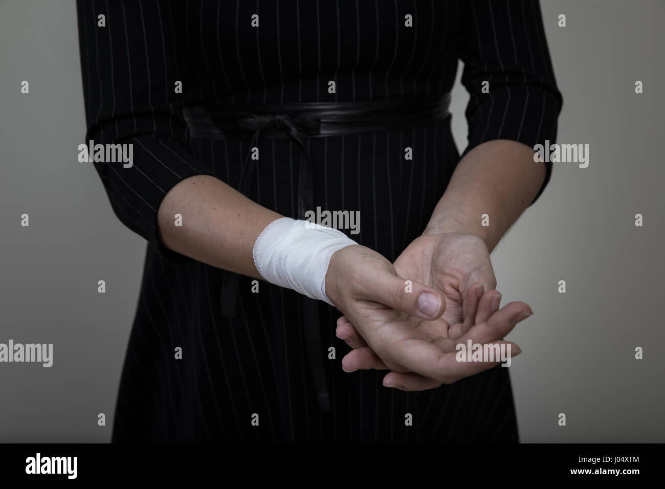 Mittelalter Frau zeigt die Narben der Selbstverletzung. Stockfoto