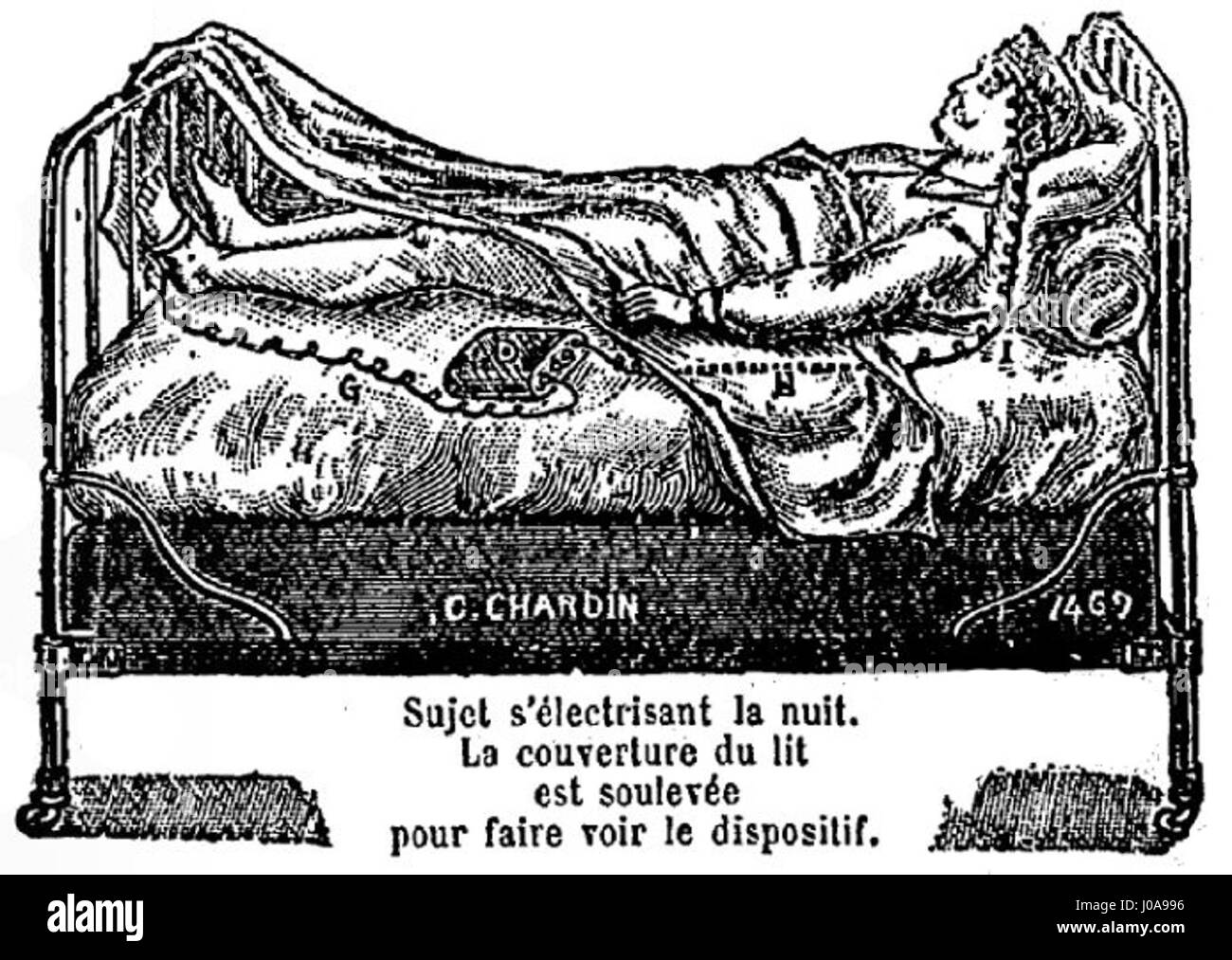 Dieses Bild zeigt einen Patienten, der sich einer elektrokinetischen Gefäßbehandlung unterzieht, einem frühen medizinischen Verfahren, das auf die Verbesserung der Blutzirkulation ausgerichtet ist. Die Methode hebt medizinische Praxen des 19. Und frühen 20. Jahrhunderts in der Gefäßgesundheit hervor. Stockfoto