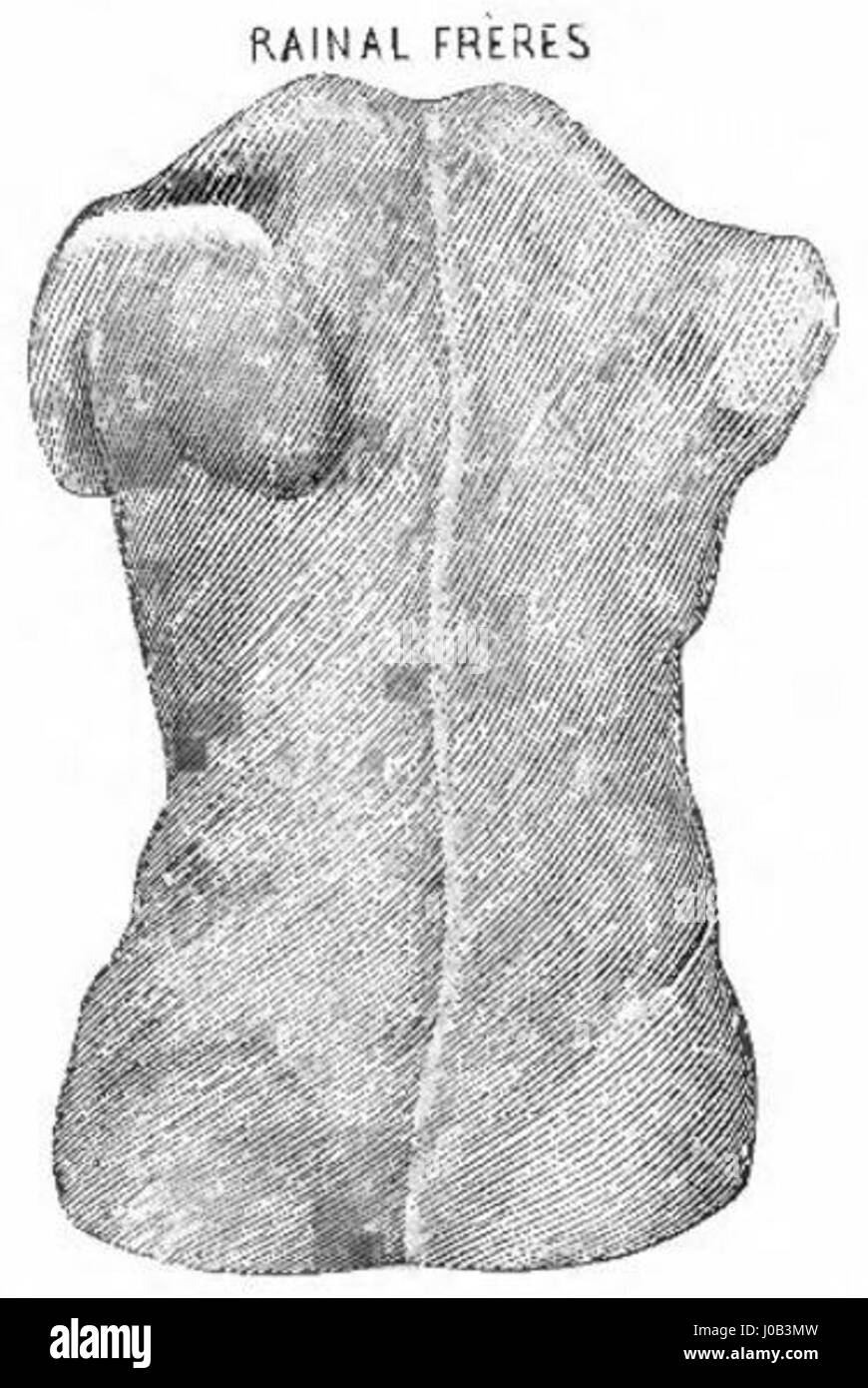 Der „Catalogue de Corsets de Rainal Frères“ enthält verschiedene Korsettendesigns. Die 175. Figur zeigt die detailreiche Handwerkskunst der Korsetts, die Modetrends und Schneidertechniken des 19. Jahrhunderts in Frankreich widerspiegeln. Stockfoto