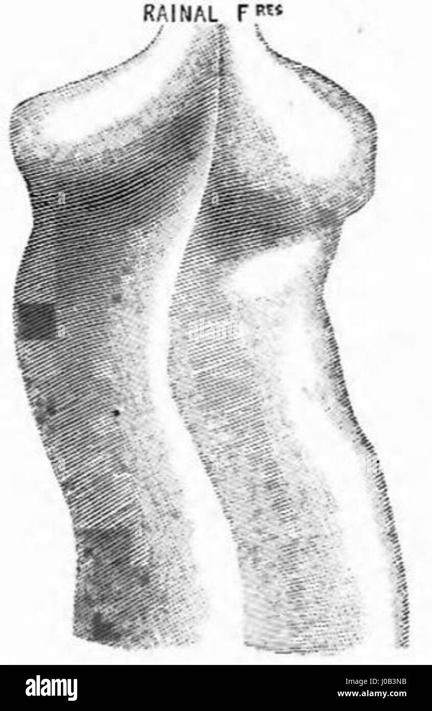 Dieser Katalog aus dem 19. Jahrhundert von Rainal Frères zeigt detaillierte Illustrationen von Korsetts, die die Rolle der Modebranche bei der Gestaltung der damaligen Kleidung hervorheben. Es spiegelt die komplizierten Design- und Modetrends des späten 19. Jahrhunderts wider. Stockfoto